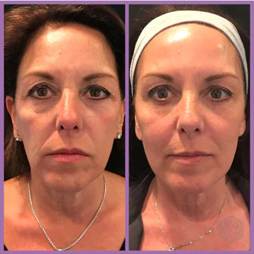 Ethereal Microcurrent Facial Toner