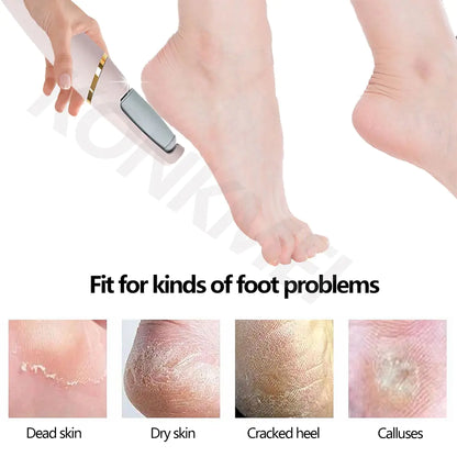 Pedicure Foot Care