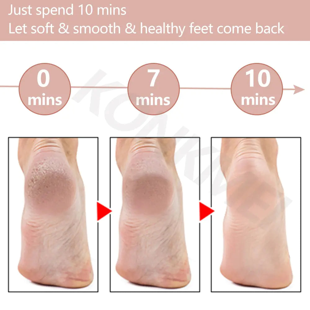 Pedicure Foot Care